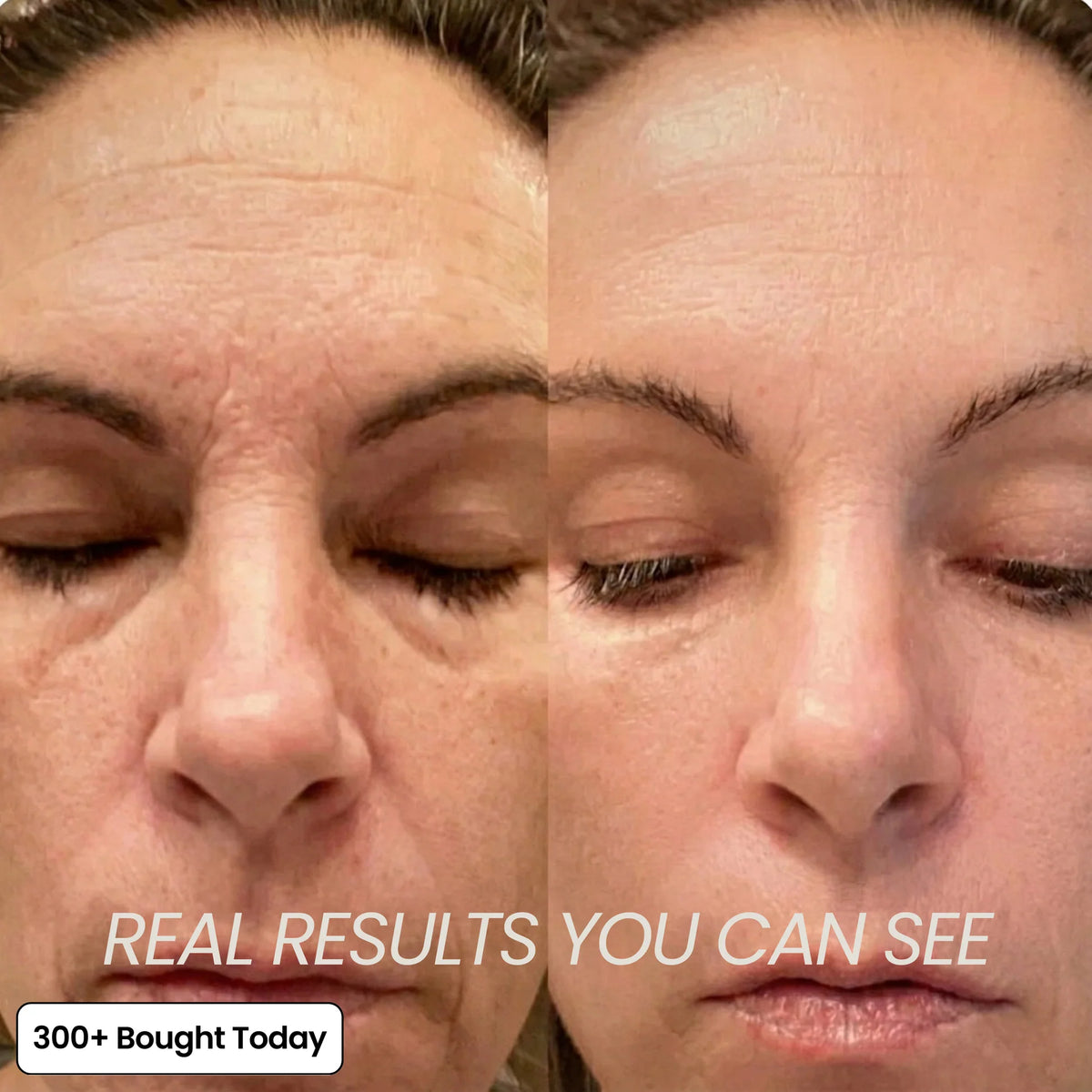 anti wrinkle balm stick glowing skin result
