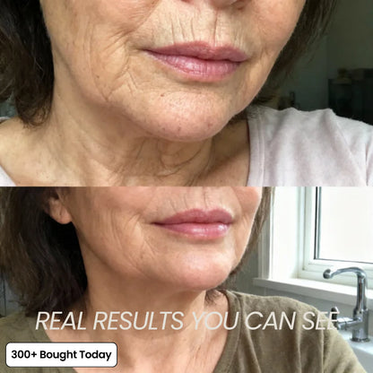 anti wrinkle balm stick before and after