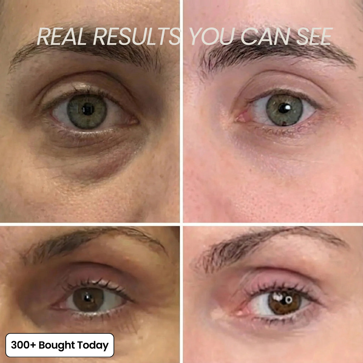 anti wrinkle balm stick before and after